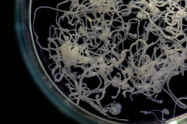 Parazit ya da solucanlar eğitim laboratuvarında bulunan bir tatlı su balığı parazitidir..