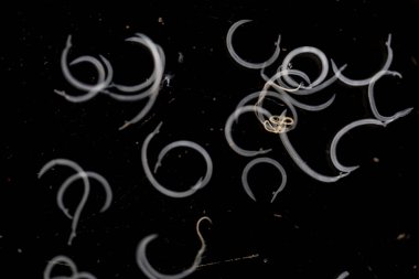 Parazit ya da solucanlar eğitim laboratuvarında bulunan bir tatlı su balığı parazitidir..