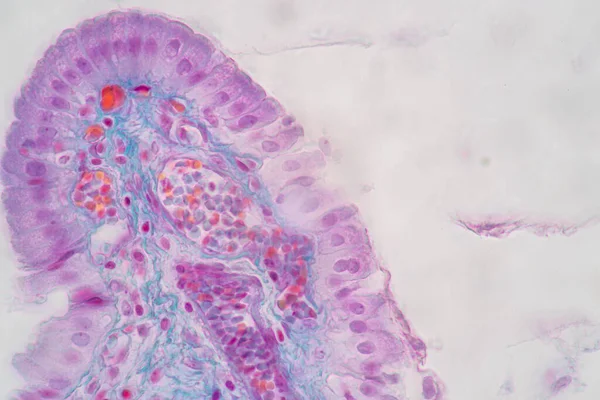 Характеристики Клітин Колонного Епітелію Людини Під Мікроскопом Навчання Лабораторії — стокове фото