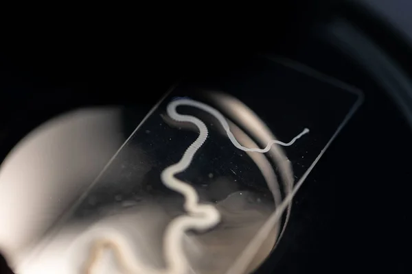 Parazit ya da solucanlar eğitim laboratuvarında bulunan bir tatlı su balığı parazitidir..