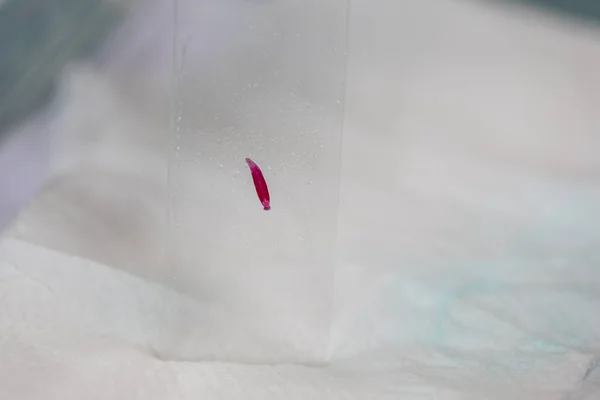 Parazit Solucanlar Eğitim Laboratuvarında Bulunan Bir Tatlı Balığı Parazitidir — Stok fotoğraf