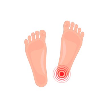 İnsan ayağı dürtüsü ve acısı. Dermatoloji ve kozmetik problemi ayak yorgunluğu, yanlış ayakkabı konseptini kullanmanın sonuçları. Tıbbi sitelerin sembolü, uygulama. düz basit işaret beyaz üzerine izole