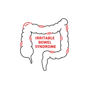Doğrusal asabi bağırsak sendromu işareti. İlaç konsepti, kalın bağırsak ve rektumda hapların çözünmesi. Anatomi elementi, uygulamalar için sağlık hizmeti, bilgi grafikleri posteri. beyaz üzerine izole nesne