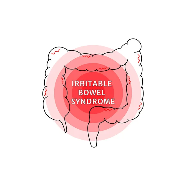 Irritábilis Bél Szindróma Jele Orvosi Fogalom Tabletták Feloldódása Vastagbélben Végbélben — Stock Vector