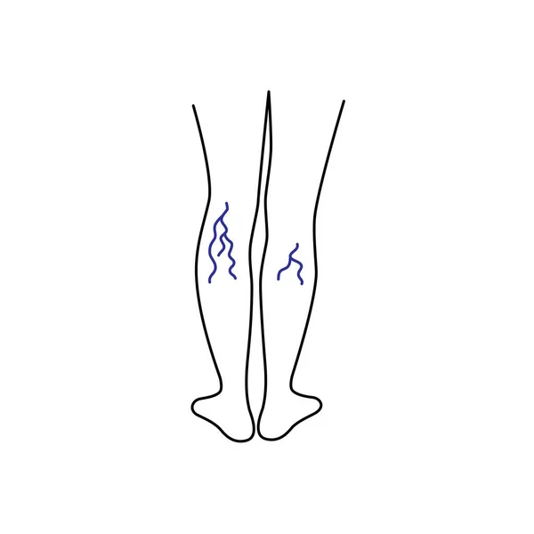 Lineární Černé Nohy Žilami Koncepce Křečového Problému Tromboflebitidy Končetin Cirkulace — Stockový vektor