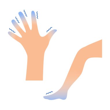 Titreyen ve titreyen el ve bacak. Soğuk ısırması, hipotermi, hastalık, korku, sinir durumu, kan dolaşımı, soğuğa duyarlılık, sağlıksız vücut. Beyaz arkaplanda basit bir şarkı