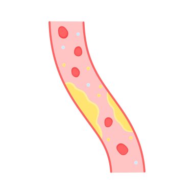 Kolesterollü renkli kan damarı. Bileşik hücre konsepti, hipertansiyon, kardiyoloji, miyokardiyal. Hastalığı incelemek için eğitim planı. beyaz arkaplanda düz dizayn işareti