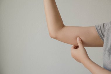 Woman checking fat upper arm.Healthcare. 