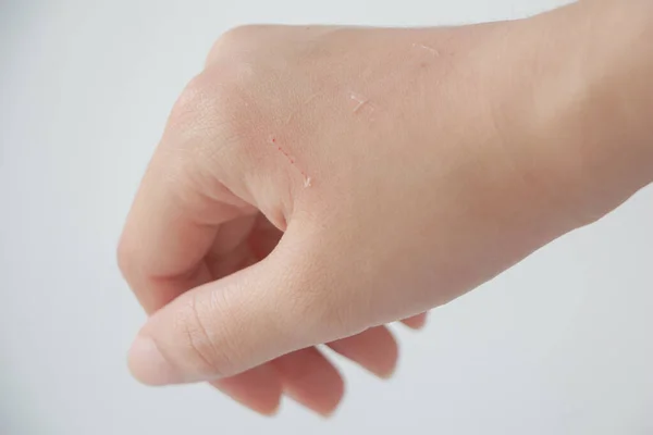 Close Hand Scratched Cat — Foto Stock