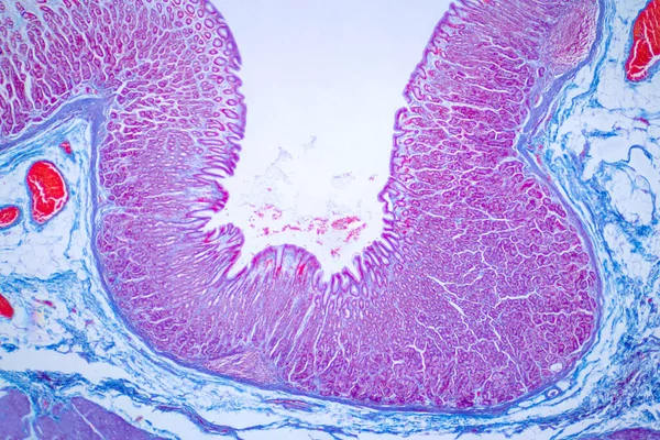 结肠镜活检 病理报告描述正常结肠黏膜碎片与结肠腺体 Haematoxylin Eosin Staining Technique Slide — 图库照片