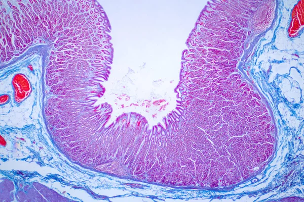 Biopsja Okrężnicy Kolonoskopii Raport Patologiczny Opisuje Normalny Fragment Błony Śluzowej — Zdjęcie stockowe