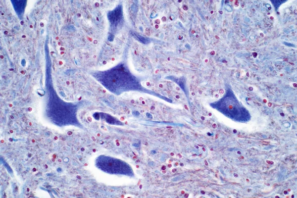 脊髄の運動ニューロンの光顕微鏡は中枢神経系の一部である ヒト組織のためのヘマトキシリンおよびエオシン染色技術 — ストック写真
