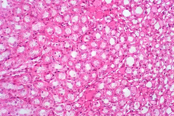 光学显微镜下的人体肾组织组织学研究 Haematoxylin Eosin Staining Technique Histology — 图库照片