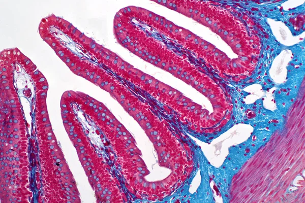 Biopsie Côlon Par Coloscopie Rapport Pathologie Décrit Fragment Normal Muqueuse — Photo