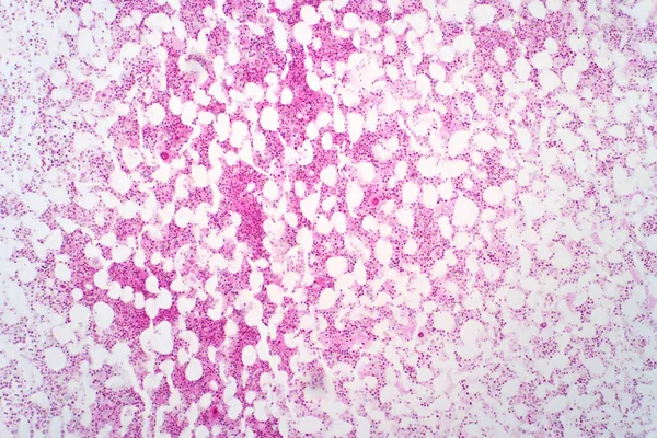 Médula Ósea Humana Bajo Vista Del Microscopio Técnica Tinción Hematoxilina —  Fotos de Stock