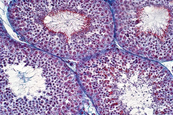 Людина Дає Свідчення Під Мікроскопом Показує Сперматогонію Сперматоцити Мейозі Сперматидах — стокове фото