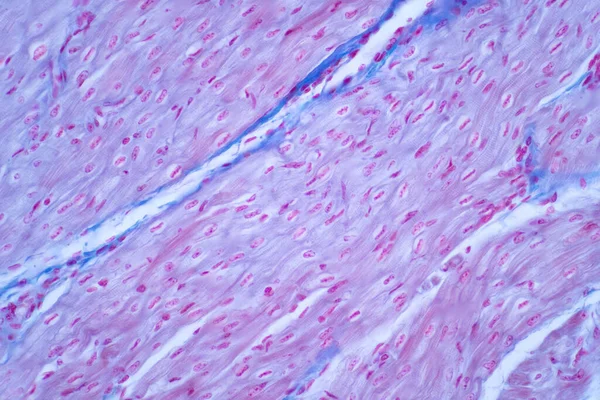 Histologie Van Menselijke Hartspier Onder Microscoop Bekijken Voor Onderwijs Human Rechtenvrije Stockafbeeldingen