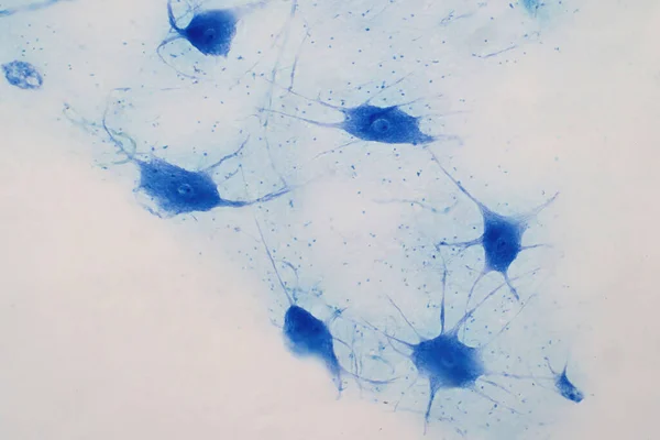 Neuronen Cellen Uit Hersenen Onder Het Licht Microscoop Uitzicht Voor Rechtenvrije Stockfoto's