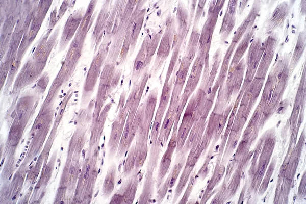 Histologie Van Menselijke Hartspier Onder Licht Microscoop Uitzicht Voor Onderwijs Stockfoto