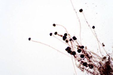 Eğitim için ışık mikroskobik görünümü altında Aspergillus (küf).