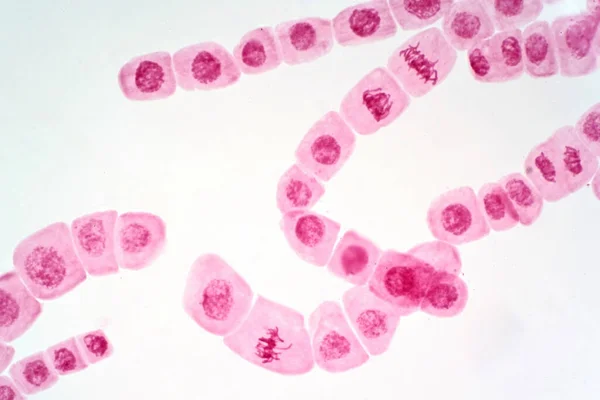 Cellule Mitose Extrémité Racinaire Oignon Sous Vue Microscope Photonique — Photo