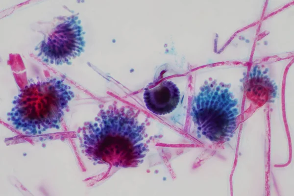 Aspergillus Pleśń Pod Mikroskopowym Światłem Dla Edukacji — Zdjęcie stockowe