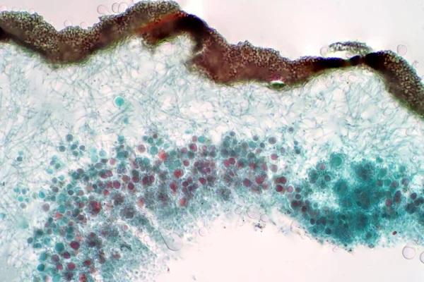 Lichen Fungus 光镜下教育生物学的横断面滑移 — 图库照片