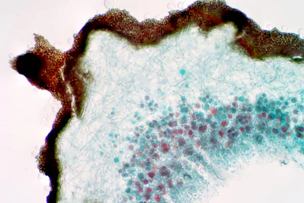 Lichen Fungus 光镜下教育生物学的横断面滑移 — 图库照片