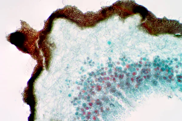 Лишайник Грибок Поперечное Сечение Слайд Световой Микроскоп Зрения Образования Биологии — стоковое фото
