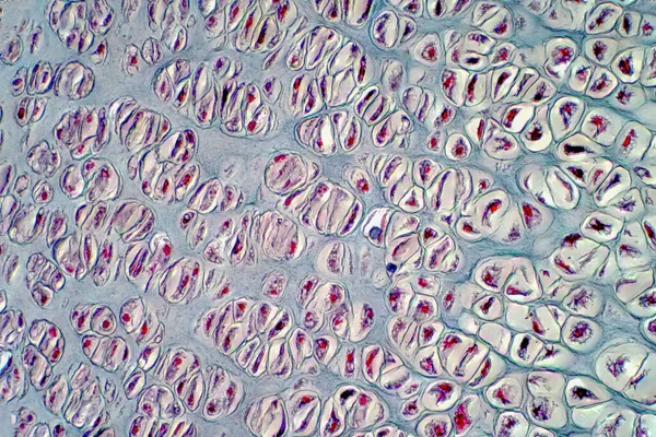 가벼운 현미경으로 수있는 인간의 연골은 조직학 교육을 것이다 조직학을 Haematoxylin — 스톡 사진