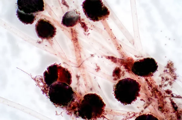 Aspergillus Schimmel Unter Dem Lichtmikroskop Für Die Ausbildung — Stockfoto