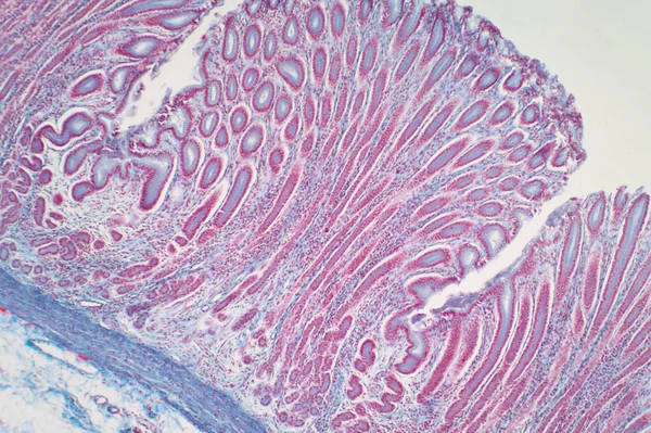 Colon Biopsie Van Colonoscopie Het Pathologierapport Beschrijft Normale Darmslijmvliezen Met Stockafbeelding