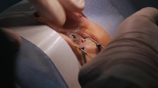 Correction Vue Laser Patient Une Équipe Chirurgiens Dans Salle Opération — Video