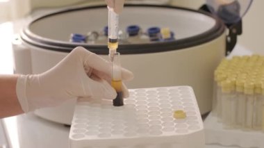 Trombosit zengini plazma hazırlığı. Elleri kanlı tüp.