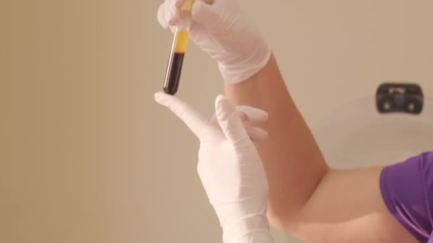 Preparação Plasma Rico Plaquetas Tubo Com Sangue Nas Mãos — Vídeo de Stock