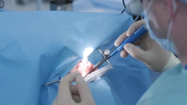 Opération Pour Enlever Les Amygdales Dans Clinique Moderne Sous Anesthésie — Video