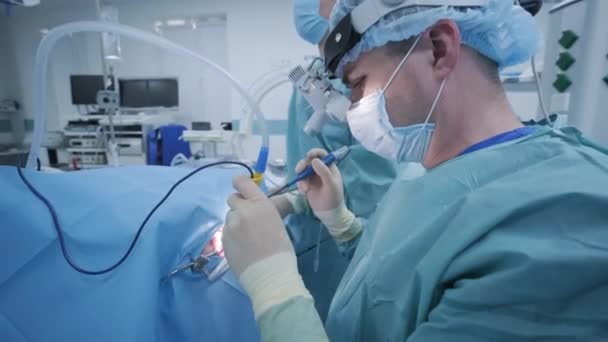 深い麻酔下で扁桃腺を除去する操作 外科医は 最新のデバイスを使用しています 冷間プラズマ法 喉の腫れをカット 医師は新しいプローブで動作します 医療ヘッドランプ 外科ルーペ — ストック動画