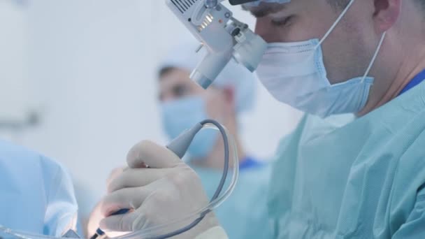 深い麻酔下で扁桃腺を除去する操作 外科医は 最新のデバイスを使用しています 冷間プラズマ法 喉の腫れをカット 医師は新しいプローブで動作します 医療ヘッドランプ 外科ルーペ — ストック動画