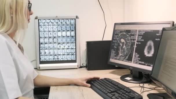 Professionell Kvinnlig Läkare Radiolog Undersöker Hjärnan Datortomografi Eller Mrt Skanna — Stockvideo