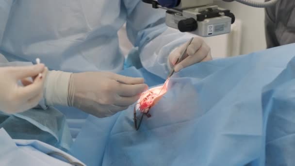Equipo Cirugía Que Realiza Cirugía Estrabismo Utilizando Tecnologías Modernas Los — Vídeos de Stock