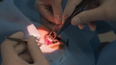 Cerrahi ekibi modern teknolojileri kullanarak strabismus ameliyatı yapıyor. Modern klinikteki son cihazlar. Cerrah gözü dikiyor.