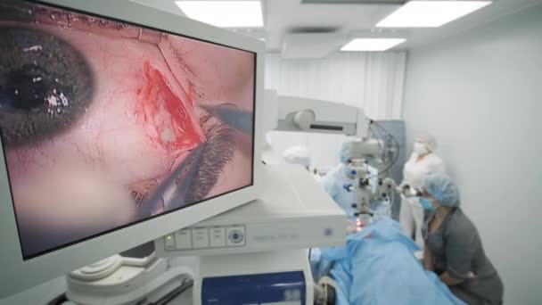 Surgery Team Making Strabismus Surgery Using Modern Technologies Latest Devices — Wideo stockowe