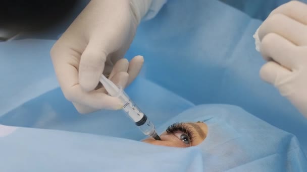 Surgery Correct Strabismus View Microscope Surgeon Sews Eye Ophthalmic Surgery — Wideo stockowe