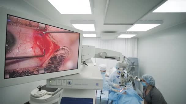 Squadra Chirurgia Che Effettua Chirurgia Dello Strabismo Utilizzando Tecnologie Moderne — Video Stock