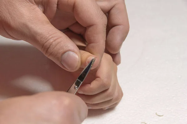 Mann schneidet Kindern mit kleiner Schere Messer auf den Arm. — Stockfoto