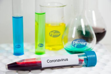 Pfizer kimya laboratuarı aletleri, cam eşyalar ve pipetler. Laboratuvarda testler ve araştırmalar. Aşı yapılıyor.