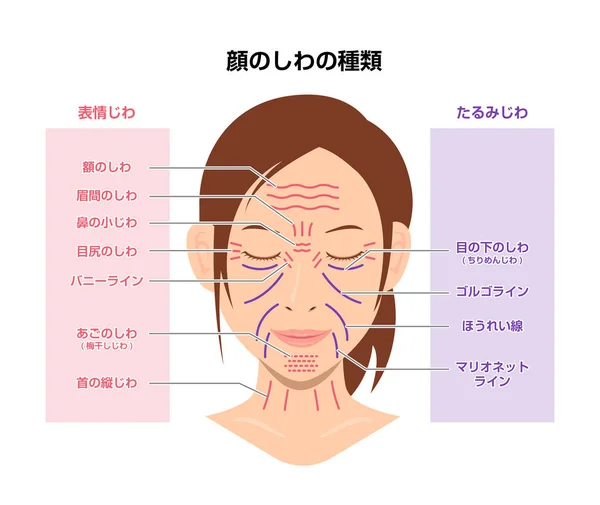 Ρυτίδες Έκφρασης Και Παλαίωση Ρυτίδων Γυναικείο Πρόσωπο Διανυσματική Απεικόνιση Ιαπωνικά — Διανυσματικό Αρχείο