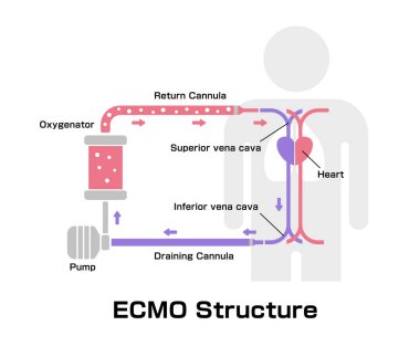 ECMO (Extracorporeal membrane oxygenation) yapı vektörü çizimi