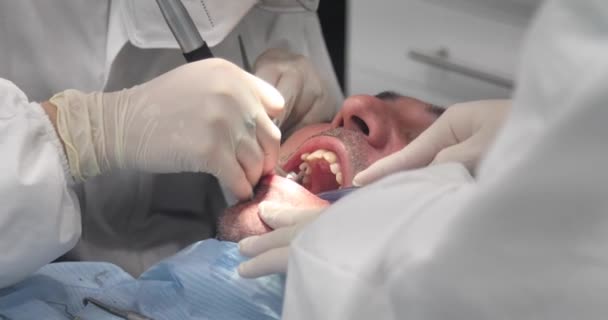 4K歯科医院で男性患者を掃除するプロの歯を作る歯科医 健康の概念 歯医者 — ストック動画