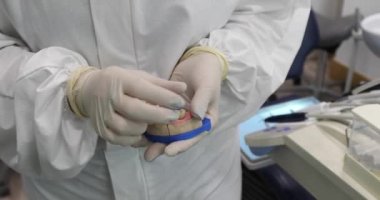 Diş implantlarının kurulum süreci gösteriliyor